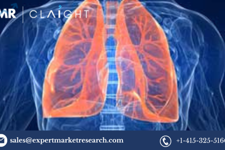 Acute Lung Injury Treatment Market: Trends, Growth, and Competitive Landscape