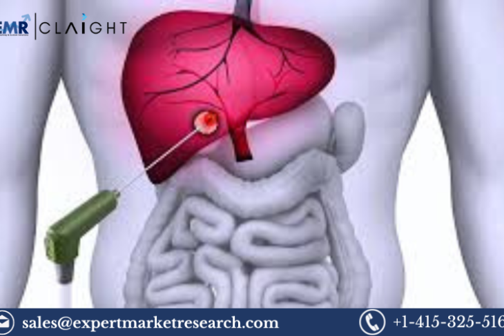 Tumor Ablation Market Insights 2024-2032: Growth, Trends & Key Players